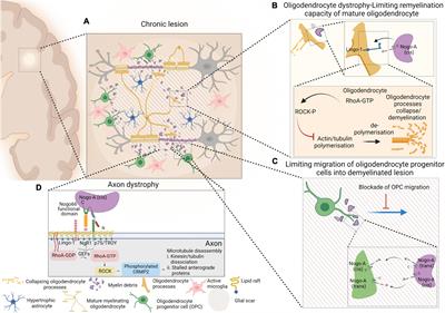 How does Nogo receptor influence demyelination and remyelination in the context of multiple sclerosis?